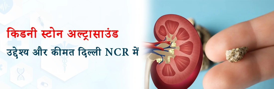 किडनी स्टोन अल्ट्रासाउंड: उद्देश्य और कीमत दिल्ली NCR में।